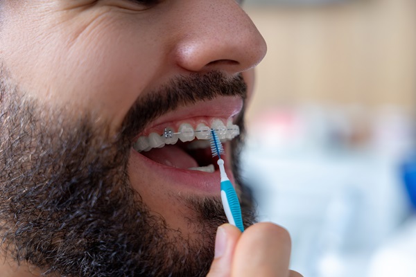 How To Maintain Your Oral Health With Clear Braces From A General Dentist